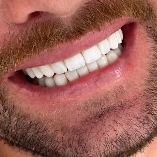 576378876_1004929805148856_3324857861704549993_n
